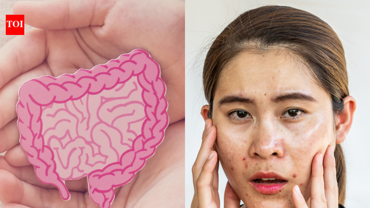 Gut Health: Skin problems that may be happening due to poor gut health