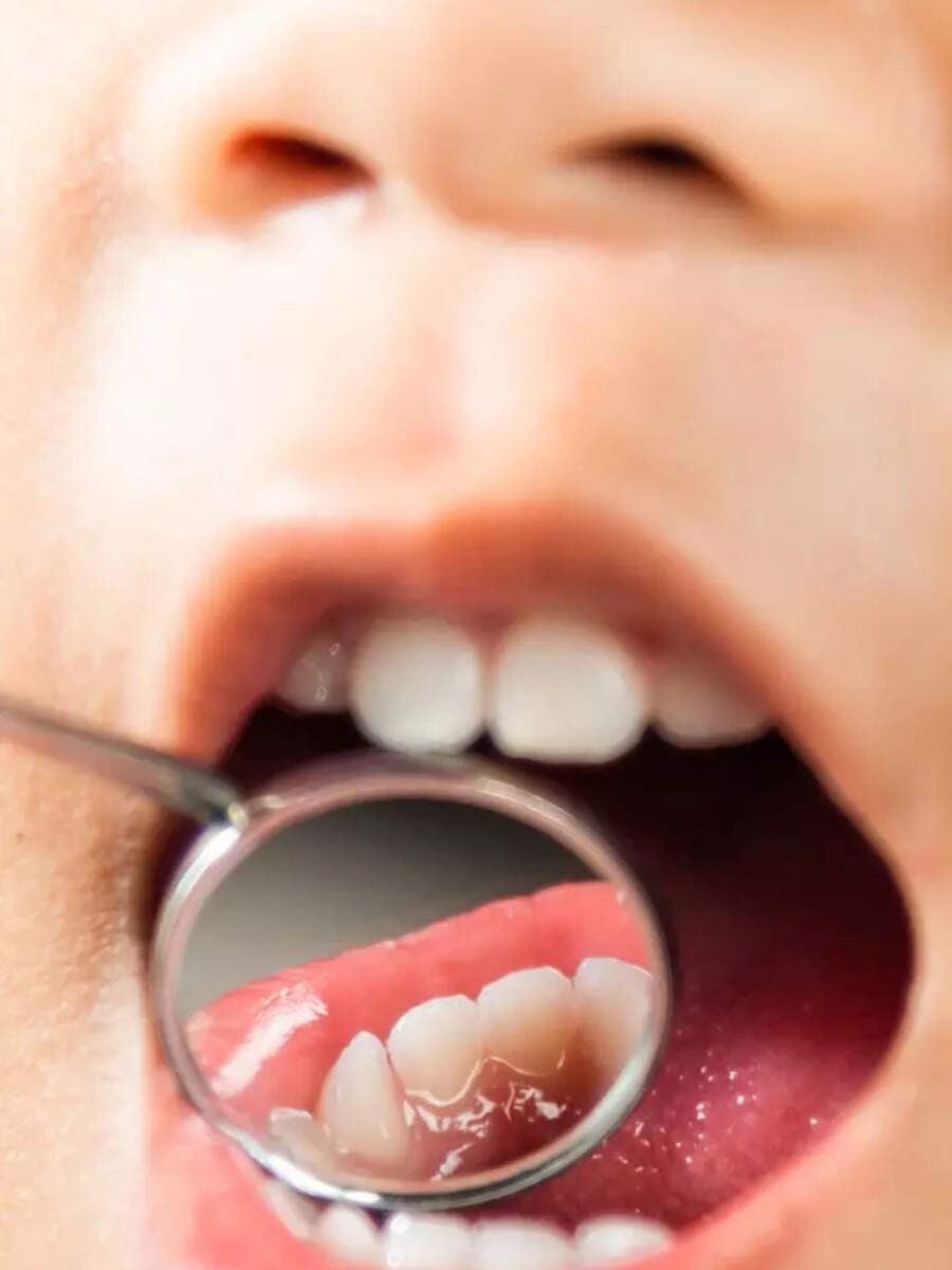 10 superfoods for amazing dental health