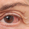 Eye stroke: Symptoms, risks, and treatment
