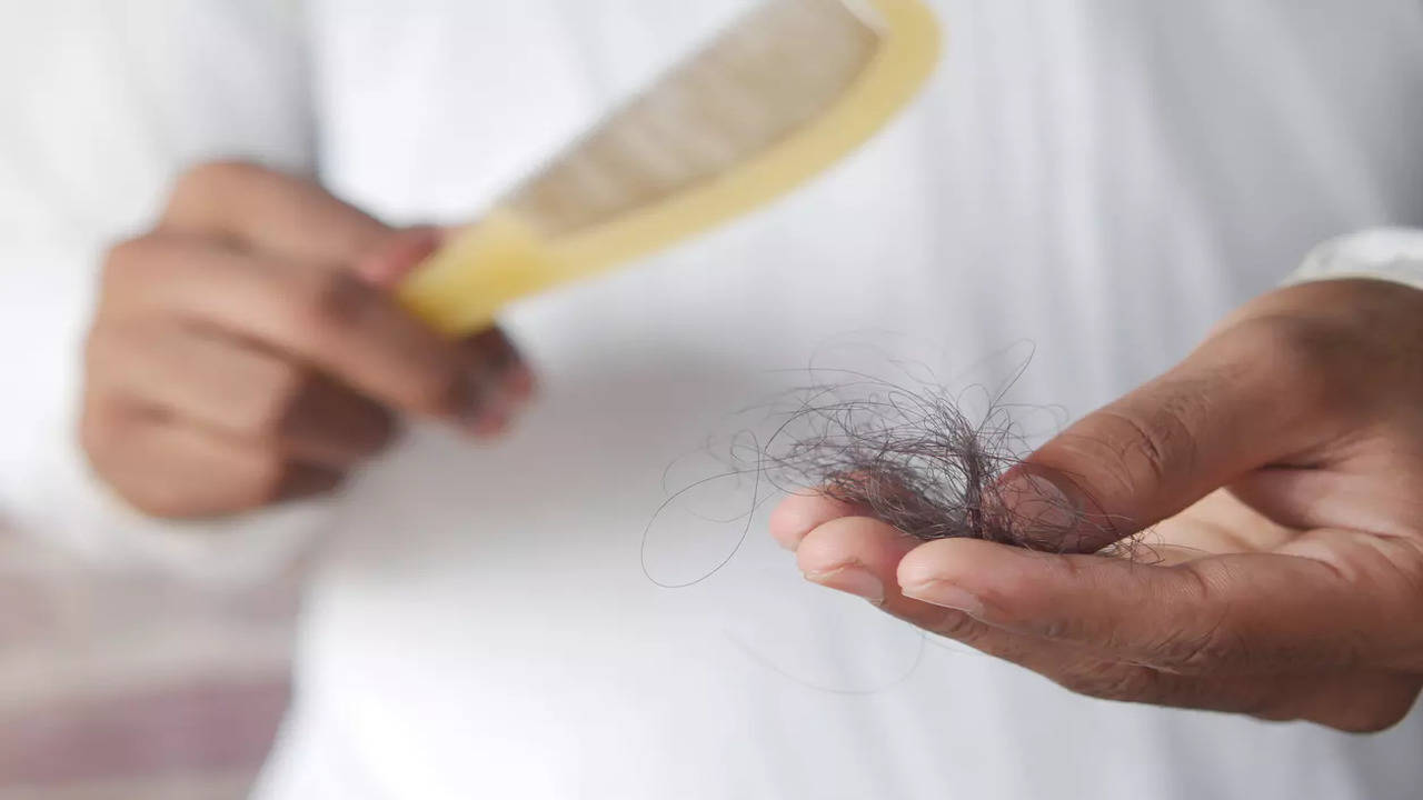 Diabetes and hair loss connection   Times of India