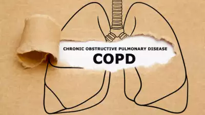 Smoking is the leading cause of chronic obstructive pulmonary disease