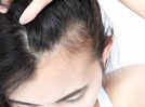 
​How to stop thinning of hair
