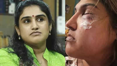 Vanitha Vijaykumar injured in an alleged physical assault in connection to Pradeep Antony's expulsion protest