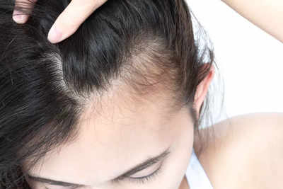 Busting myths about uneven hair growth