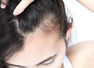 Busting myths about uneven hair growth