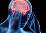 5 myths and misconceptions of traumatic brain injury