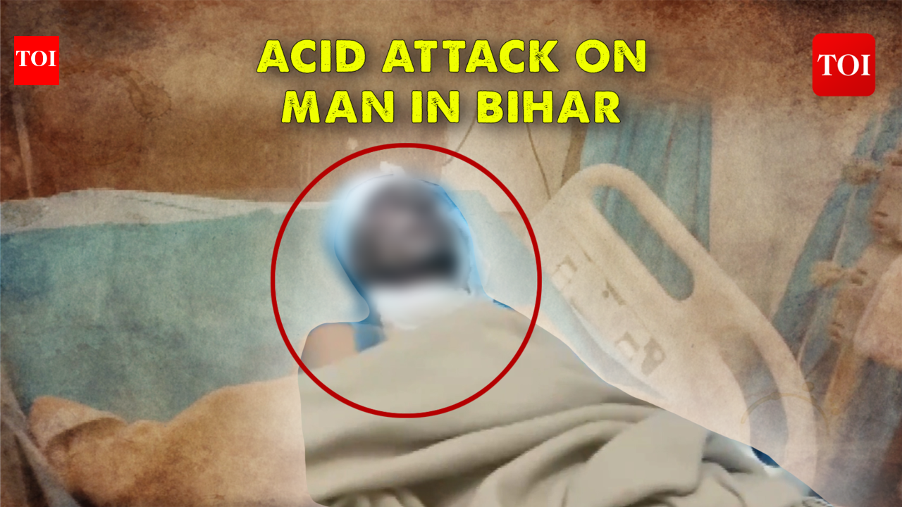 Acid attack on man after he refuses to marry girlfriend in Bihar: Probe on