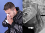 Man tears windpipe after trying to hold in a sneeze