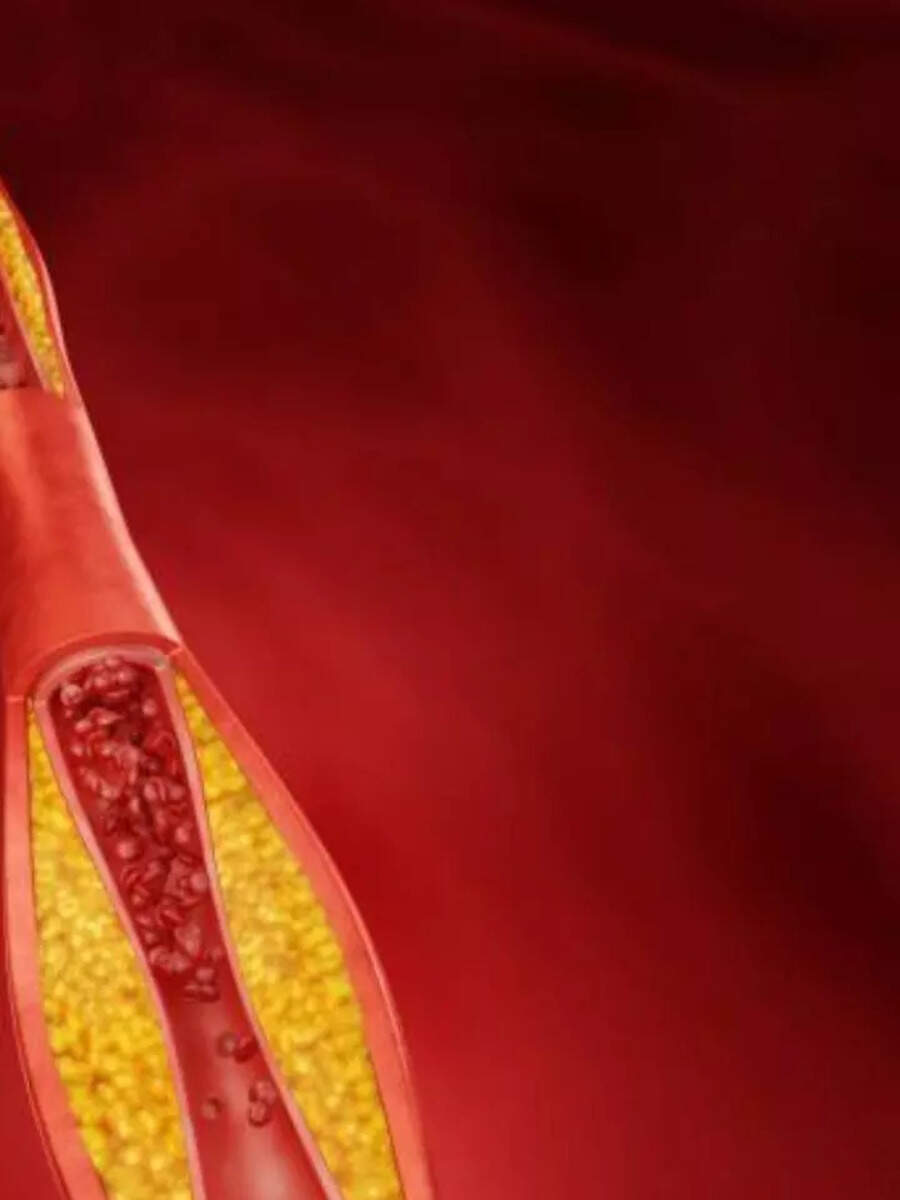 8 Vegetarian Superfoods That Prevent Clogged Arteries Times Now