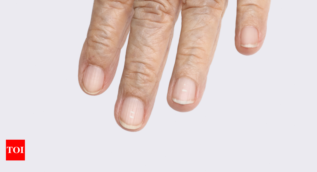 What Nails Reveal About Your Inner Nutrition Status