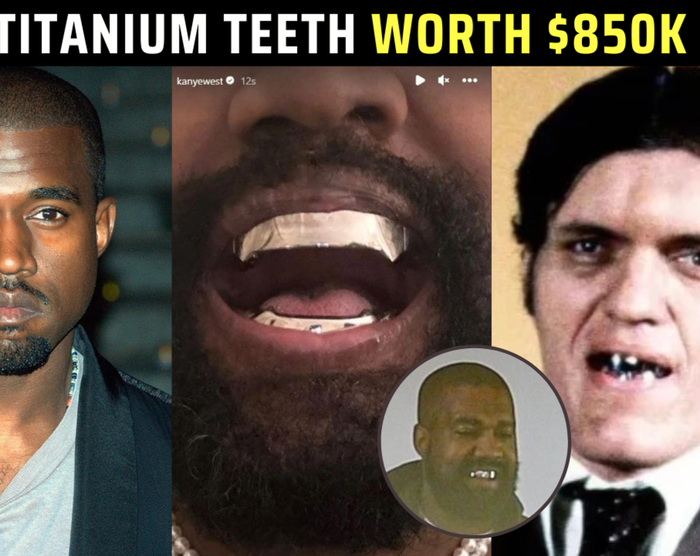 
Kanye West debuts $850K titanium teeth inspired by James Bond villain
