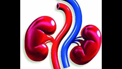 In rare op, DK docs remove 4kg kidney from 52-year-old woman