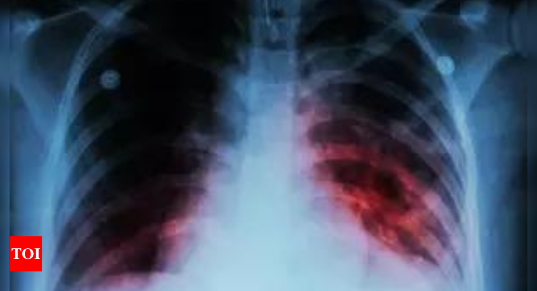 Novel approach identifies people at risk of developing TB: Lancet study