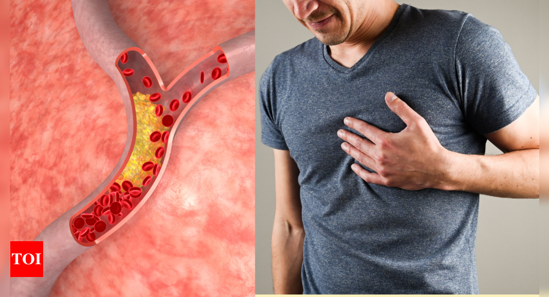 Sticky Cholesterol: 6 simple ways to bring it down |