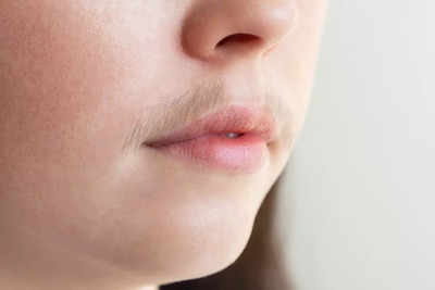 ​Home remedies to remove facial hair