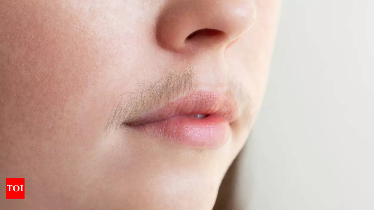 Home Remedies to Remove Facial Hair Natural Methods Times of