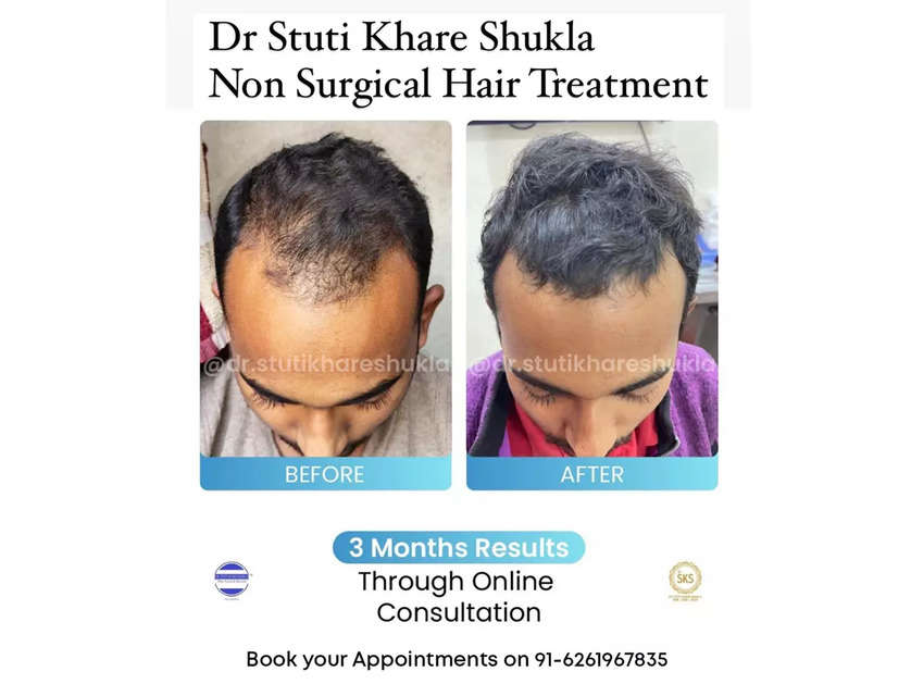 Dr Stuti Khare Shukla treating hair loss patients globally with non-surgical hair growth solution