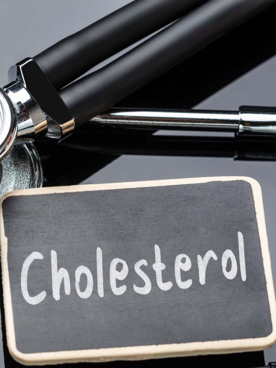 How your fingers signal high cholesterol levels - Times of India