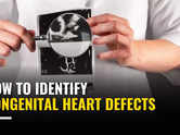 How to identify congenital heart defects