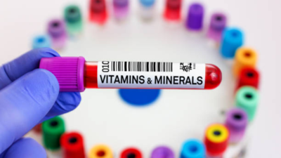 Why routine vitamin testing is essential for your health