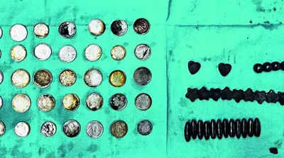Doctors remove 39 coins, 37 magnets from man’s intestine