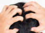 Itchy scalp? 10 guaranteed ways to get rid of it