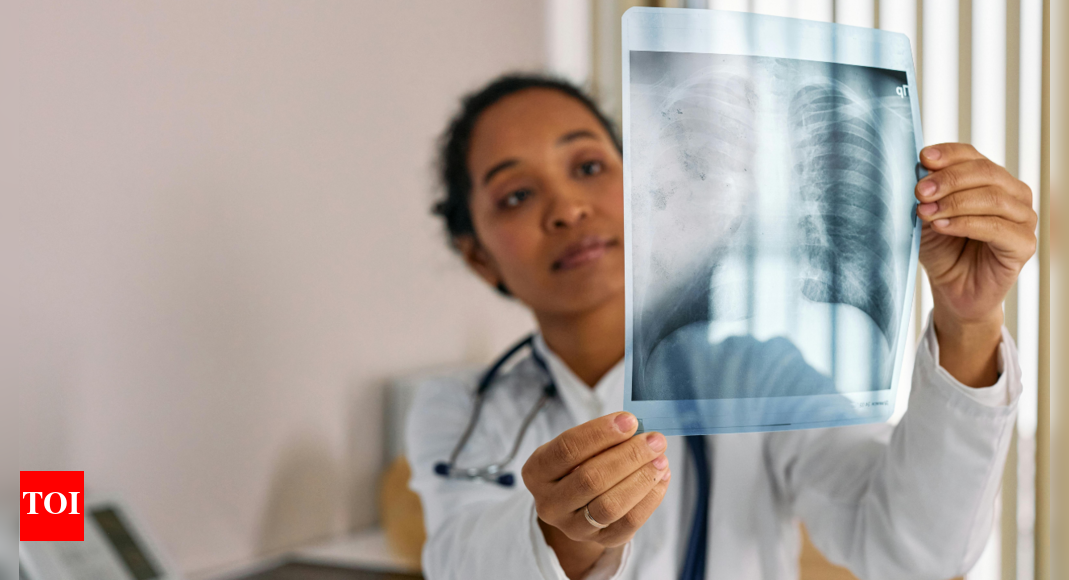 How Nicotine Replacement Therapy can curb smoking and lung damage ...