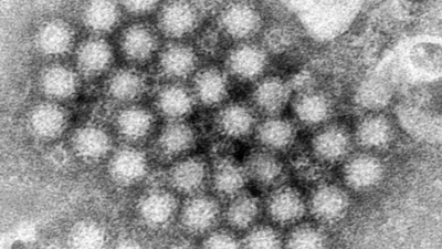 Norovirus illnesses are up in US. Here's what you need to know about the virus