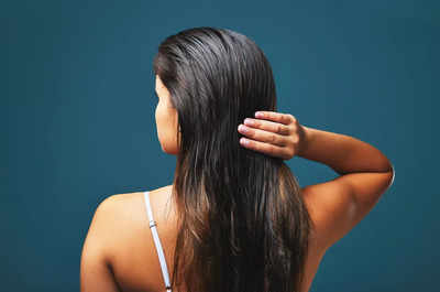 ​Perfect home remedies to deal with hair loss
