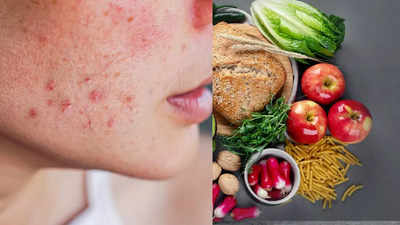 Foods that can secretly trigger skin allergies