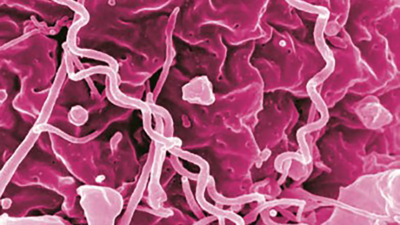 Gut-friendly bacteria could breathe life into these patients