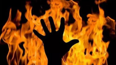Woman with M-Tech degree set ablaze by in-laws for not giving dowry