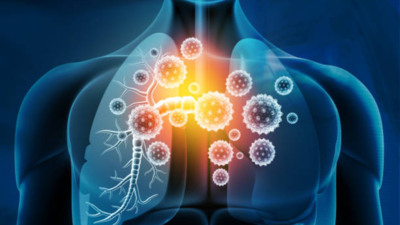 Understanding the effect of Pneumonia on kidneys, heart and lungs