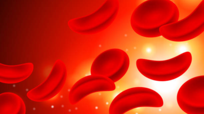 New therapies in treatment of sickle cell anemia
