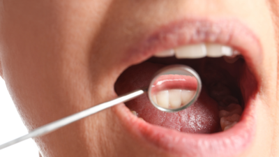 Oral Cancer: 6 things everybody should know