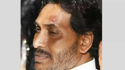 Andhra Pradesh CM Jagan Mohan Reddy hurt in stone pelting in Vijayawada