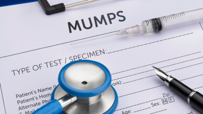 Combating Mumps: Vital preventive measures for India