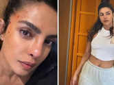 Priyanka sustains facial bruises while shooting