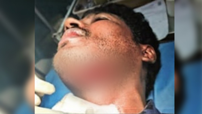 Drunk man slashes doctor’s throat at Puducherry govt hospital