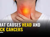 What causes head and neck cancers, expert explains