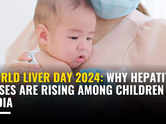 World Liver Day 2024: Why Hepatitis cases are rising among children in India