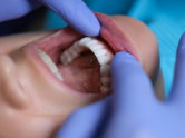 5 factors that contribute to oral cancers