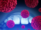 8 early signs of oral cancer common in patients