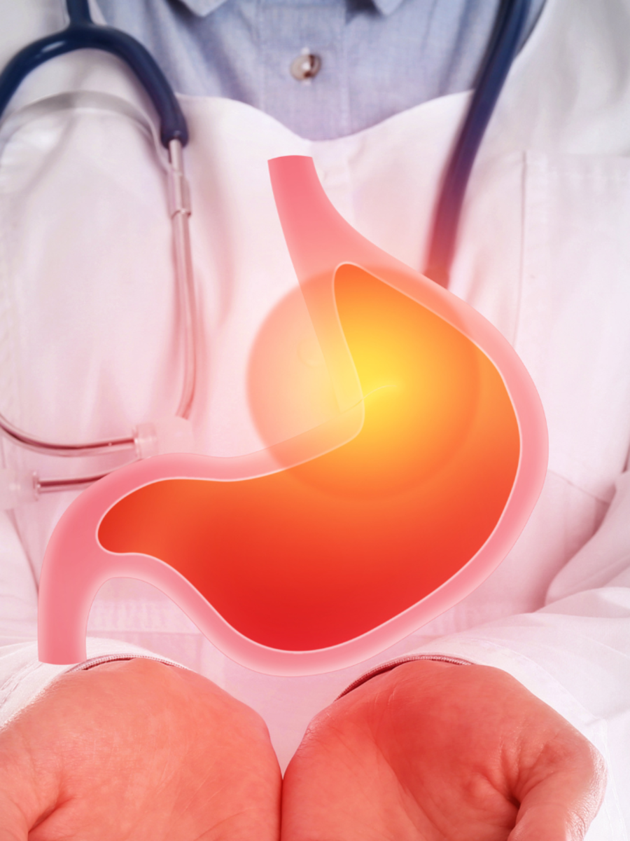 Gut Health: 8 food ingredients that destroy gut health - Vimarsana News