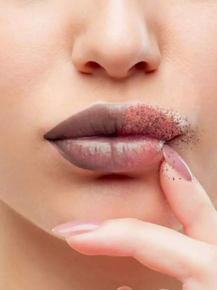  உதடுகள் கருப்பாக மாற இதெல்லாம் கூட காரணங்களாக இருக்கலாம்! 