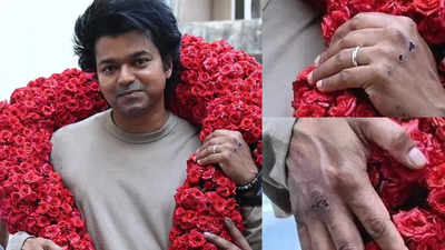 Thalapathy Vijay spotted with injuries, deets inside