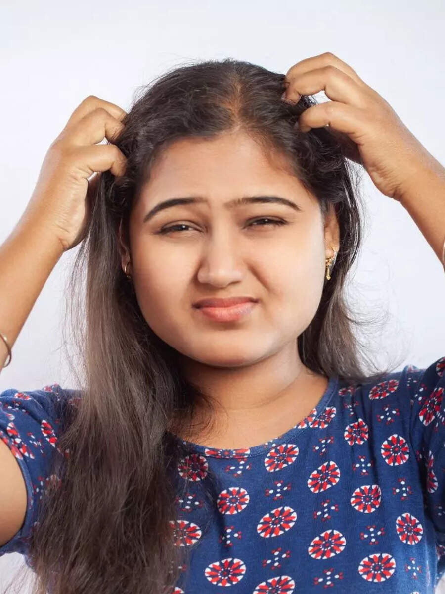  பொடுகு குறைய இந்த வீட்டு வைத்தியம் தான் பெஸ்ட்! 