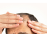 10 medical reasons behind too much hair fall