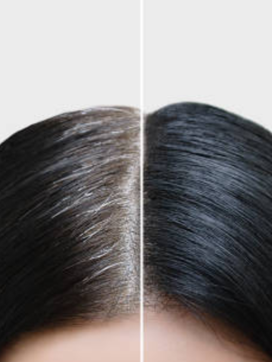 How To Turn Your Grey Hair To Black Naturally Times Now