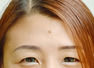 Astrological significance of moles on the forehead